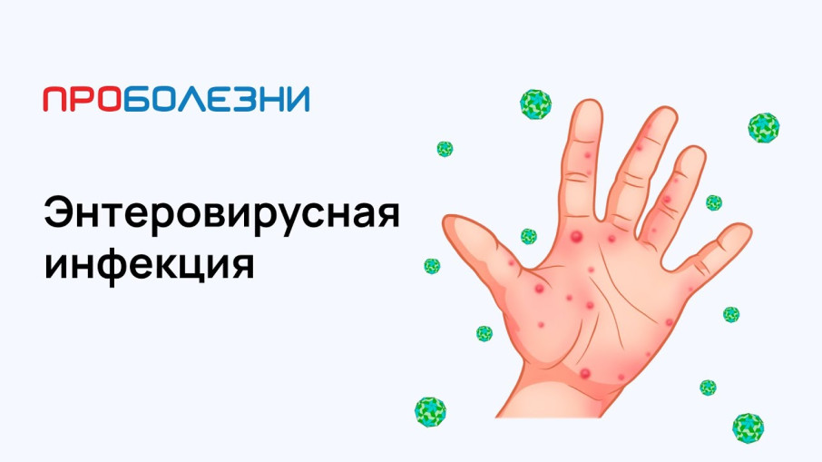 Энтеровирусная инфекция Энтеровирусная инфекция.